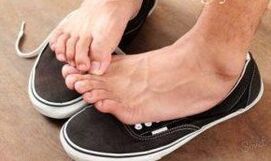 Itching as a cause of fungus