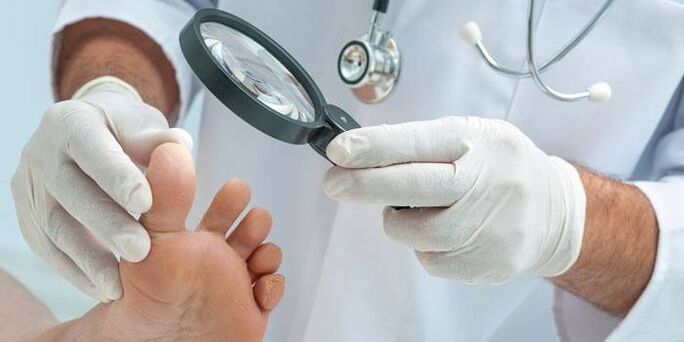 doctor examines feet for fungus between toes